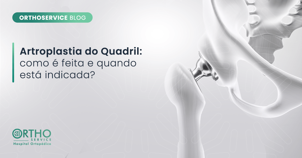 Artroplastia do Quadril como é feita e quando está indicada